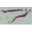 EPU Prostate cas16