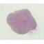 NM-TMinitiation-EPIT-13