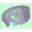 NM-TMinitiation-EPIT-12