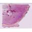 NM-TMinitiation-EPIT-15